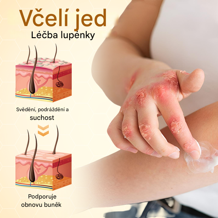 Timilk® BeeLieve Péče o pokožku s lupénkou