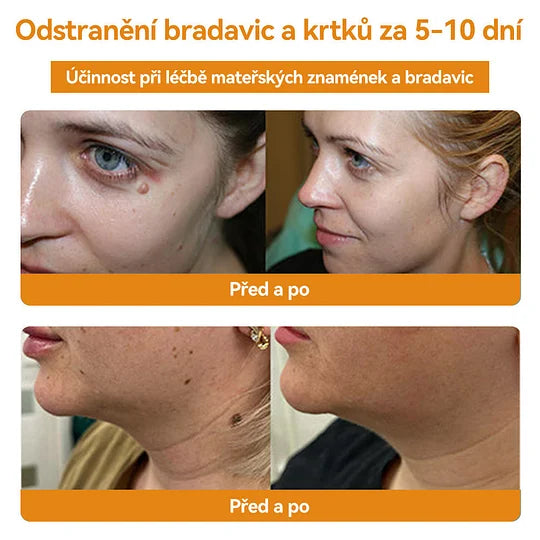 💥🔥𝐕o𝐬𝐨𝐱𝐚™ 𝐕č𝐞𝐥í𝐦 𝐉𝐞𝐝𝐞𝐦 𝐍𝐚 𝐎𝐝𝐬𝐭𝐫𝐚𝐧ě𝐧í 𝐁𝐫𝐚𝐝𝐚𝐯𝐢𝐜 𝐀 𝐙𝐧𝐚𝐦é𝐧𝐞𝐤 𝐊𝐫é𝐦🐝🐝(🔥𝐏𝐫𝐨𝐩𝐚𝐠𝐚č𝐧í 𝐚𝐤𝐜𝐞 𝐧𝐚 𝐩𝐨𝐬𝐥𝐞𝐝𝐧í 𝐝𝐞𝐧 𝟖𝟎% 𝐬𝐥𝐞𝐯𝐚)🔥💥✨