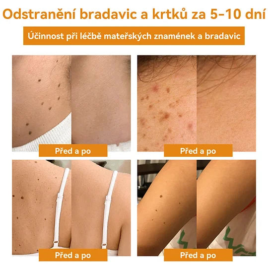 💥🔥𝐕o𝐬𝐨𝐱𝐚™ 𝐕č𝐞𝐥í𝐦 𝐉𝐞𝐝𝐞𝐦 𝐍𝐚 𝐎𝐝𝐬𝐭𝐫𝐚𝐧ě𝐧í 𝐁𝐫𝐚𝐝𝐚𝐯𝐢𝐜 𝐀 𝐙𝐧𝐚𝐦é𝐧𝐞𝐤 𝐊𝐫é𝐦🐝🐝(🔥𝐏𝐫𝐨𝐩𝐚𝐠𝐚č𝐧í 𝐚𝐤𝐜𝐞 𝐧𝐚 𝐩𝐨𝐬𝐥𝐞𝐝𝐧í 𝐝𝐞𝐧 𝟖𝟎% 𝐬𝐥𝐞𝐯𝐚)🔥💥✨