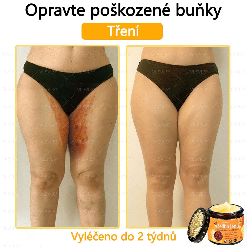 Foulme® Profesionální krém na odstranění včelího jedu🐝