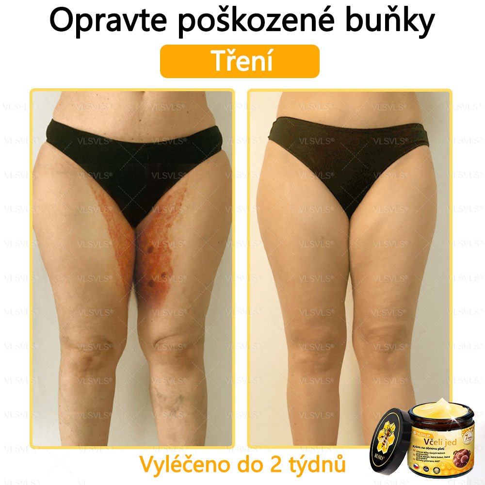 ✅VLSVLS™ Obnovující krém se včelím jedem🐝💥