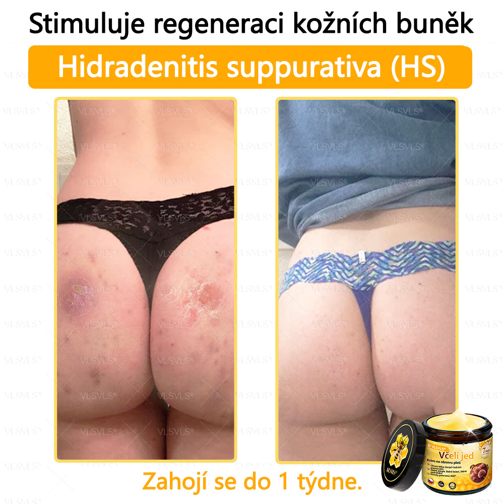 ✅VLSVLS™ Obnovující krém se včelím jedem🐝💥