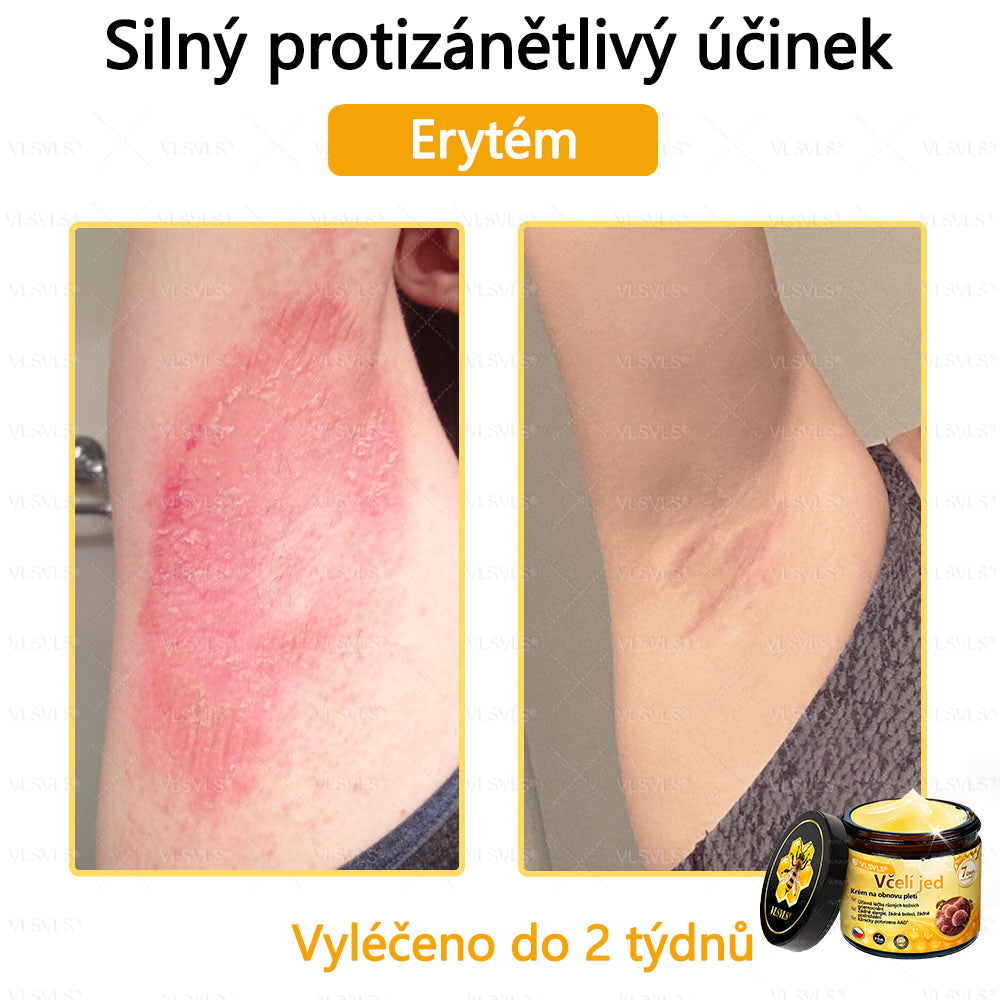 ✅VLSVLS™ Obnovující krém se včelím jedem🐝💥