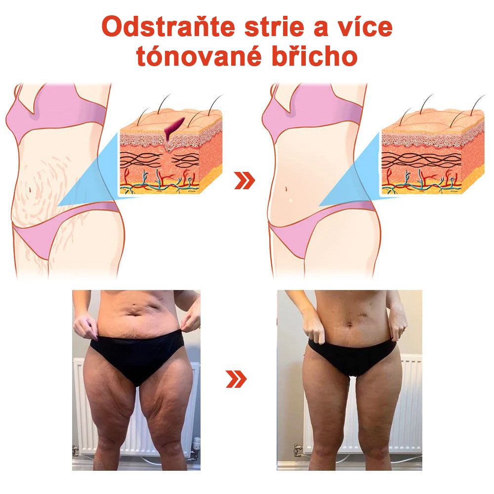 𝗦𝗧𝗗𝗘𝗜™ Zázračný luxusní tělový olej (Časově omezená sleva 80 % - poslední 1 den)🌹🔥