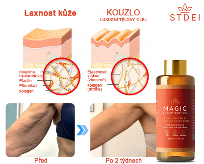 𝗦𝗧𝗗𝗘𝗜™ Zázračný luxusní tělový olej (Časově omezená sleva 80 % - poslední 1 den)🌹🔥