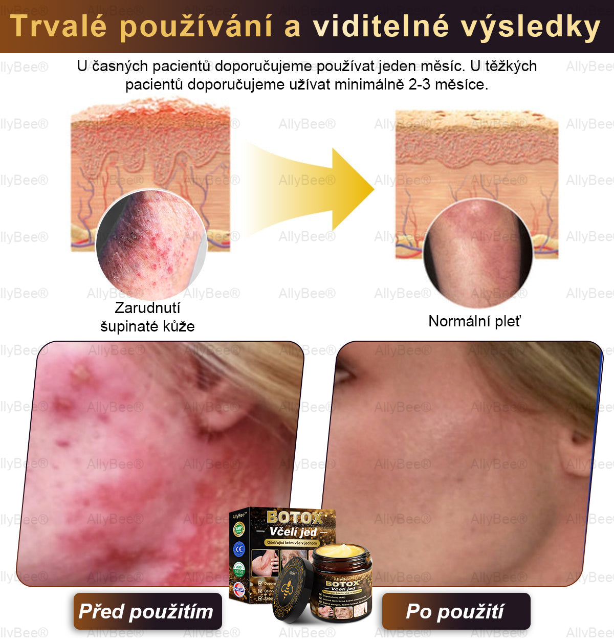 👨🔬AllyBee® Botox Krém na ošetření pleti proti stárnutí, hydratační, oprava pleti, vyrovnání tónu pleti, léčba akné a tmavých skvrn, odstraňování bradavic a mateřských znamének💥