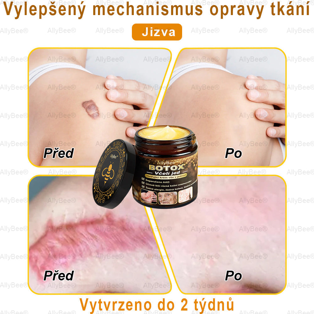 👨🔬AllyBee® Botox Krém na ošetření pleti proti stárnutí, hydratační, oprava pleti, vyrovnání tónu pleti, léčba akné a tmavých skvrn, odstraňování bradavic a mateřských znamének💥