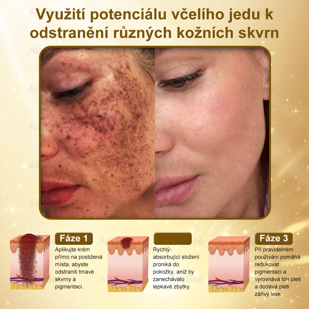👨🔬AllyBee® Botox Krém na ošetření pleti proti stárnutí, hydratační, oprava pleti, vyrovnání tónu pleti, léčba akné a tmavých skvrn, odstraňování bradavic a mateřských znamének💥