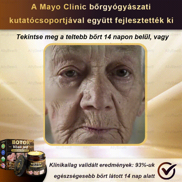 👨🔬AllyBee® Botox Krém na ošetření pleti proti stárnutí, hydratační, oprava pleti, vyrovnání tónu pleti, léčba akné a tmavých skvrn, odstraňování bradavic a mateřských znamének💥