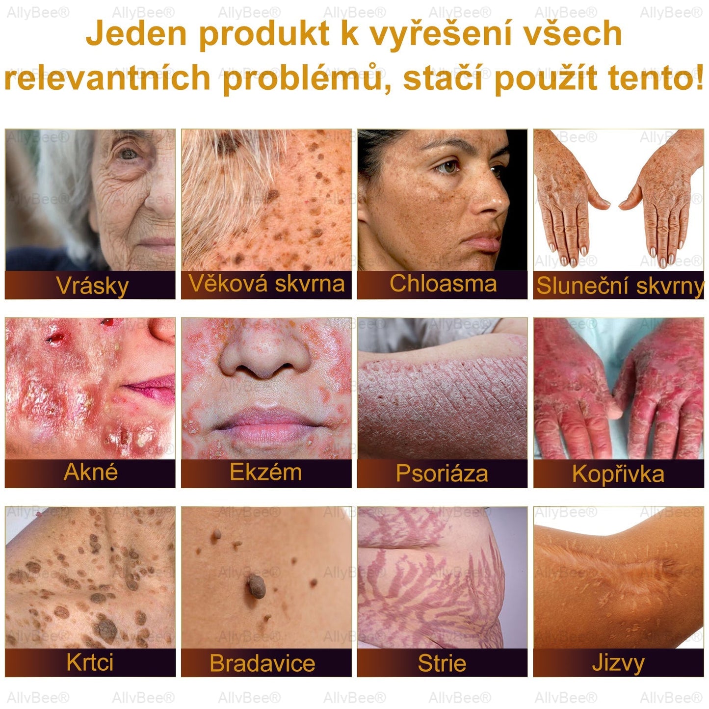 👨🔬AllyBee® Botox Krém na ošetření pleti proti stárnutí, hydratační, oprava pleti, vyrovnání tónu pleti, léčba akné a tmavých skvrn, odstraňování bradavic a mateřských znamének💥