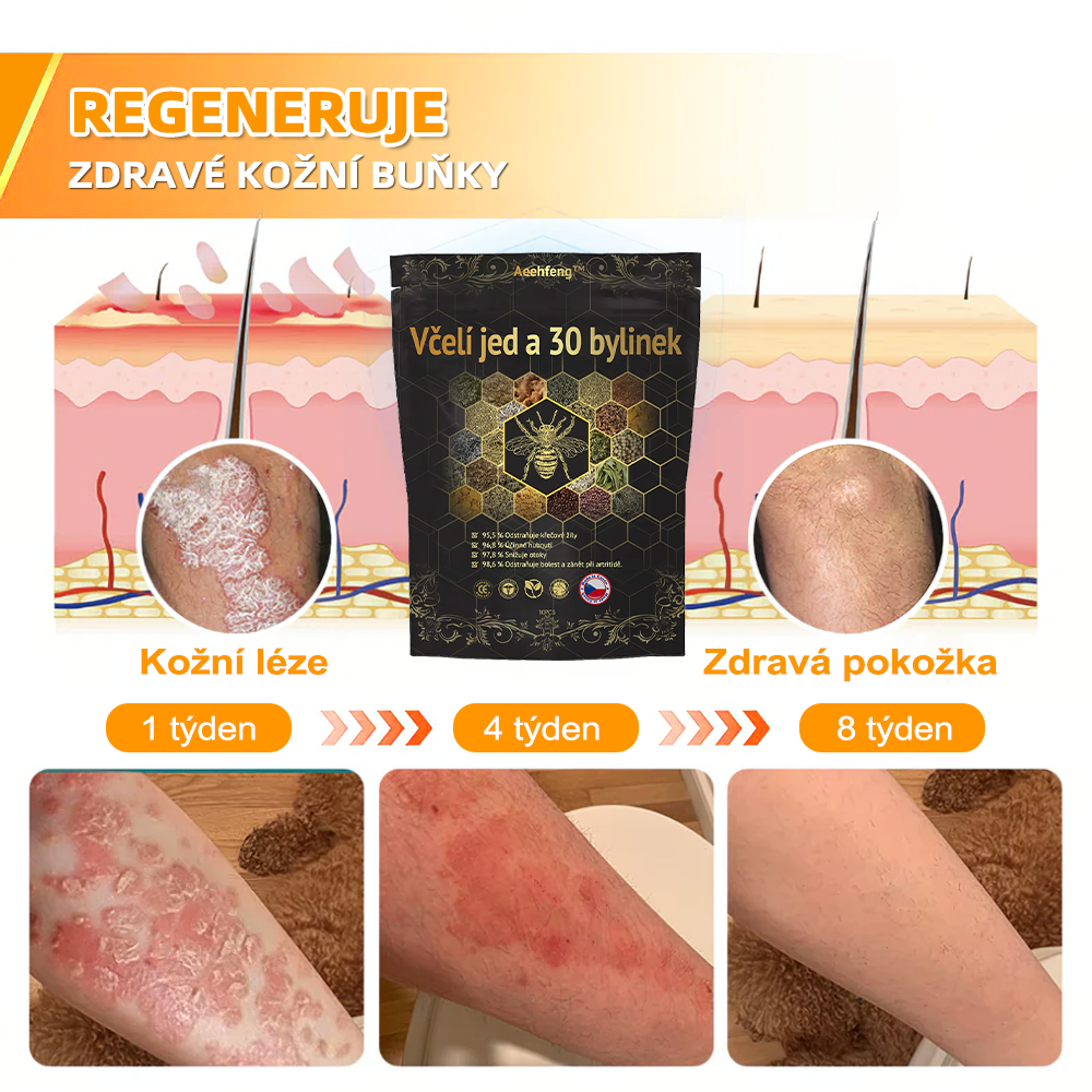 🔥💫 Poslední den na získání slevy 70 %: Aeehfeng® Včelí jed a 30 bylinek pro detoxikaci nohou a korálky pro tvarování těla - ✨Doporučeno Evropskou lymfatickou asociací (ELF) ✨🧀
