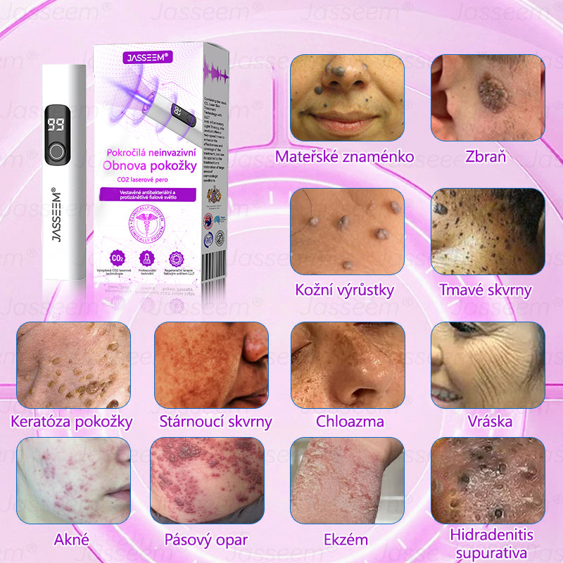 𝐉𝐚𝐬𝐬𝐞𝐞𝐦® Pokročilé neinvazivní pero s CO₂ laserem na opravu pokožky 💕 (šetrně odstraňuje bradavice, mateřská znaménka, stařecké skvrny a kožní značky - bez bolesti a rozruchu!)