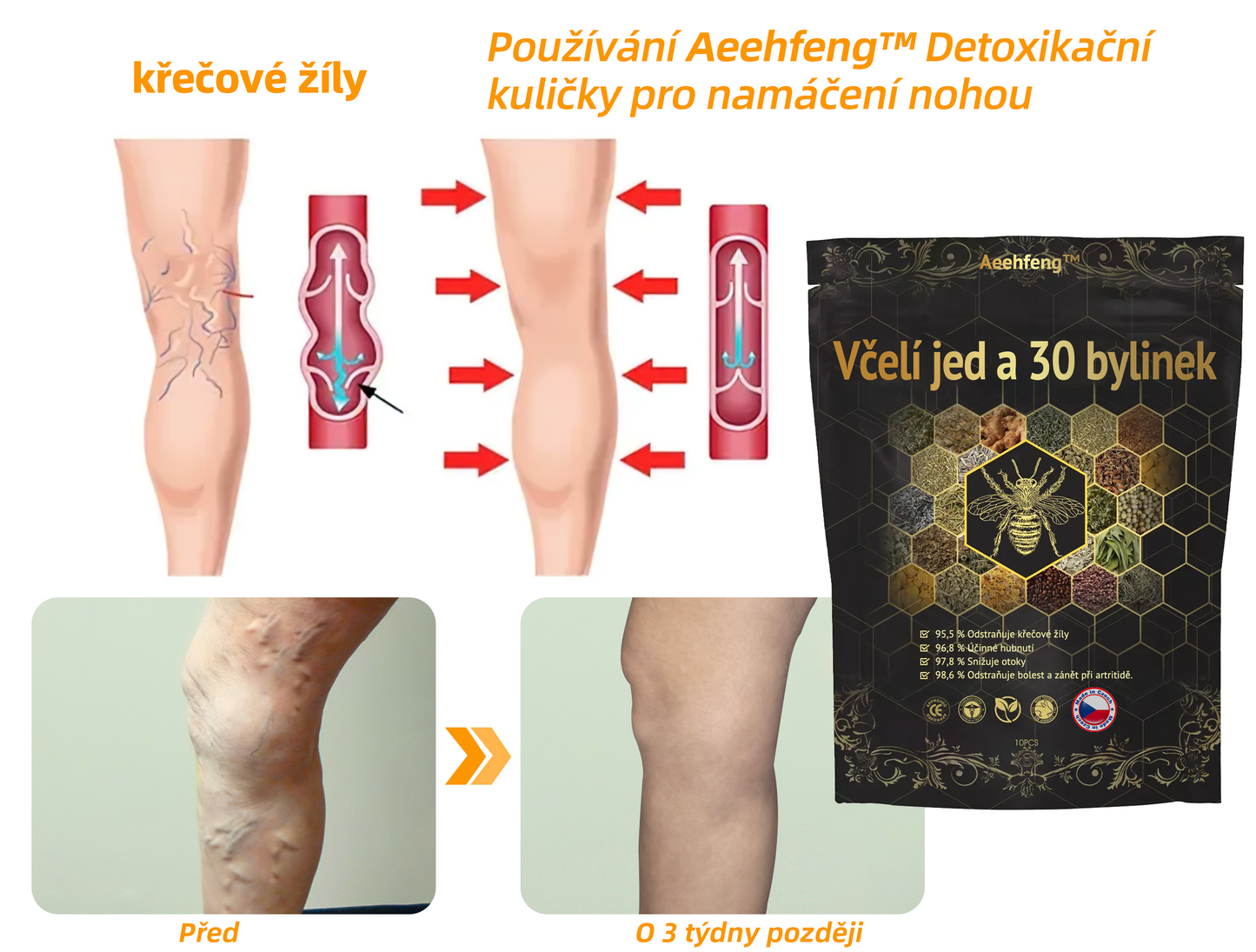 🔥💫 Poslední den na získání slevy 70 %: Aeehfeng® Včelí jed a 30 bylinek pro detoxikaci nohou a korálky pro tvarování těla - ✨Doporučeno Evropskou lymfatickou asociací (ELF) ✨🧀