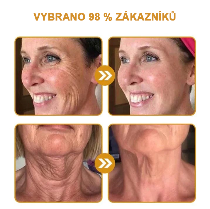 (💟Vyrobeno a odesláno z České republiky✅) Furzero™ Botox včelí jed krém na odstranění vrásek - POSLEDNÍ DEN 70% SLEVA