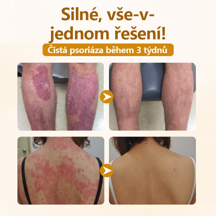 Timilk® Opravný krém s komplexem včelího jedu✨✨