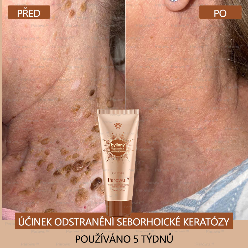 🧡Rowpin® bělící a skvrny odstraňující pleťová maska Vhodná na obličej i tělo - 👩⚕️ Přírodní složky trvale odstraňují stařecké skvrny, pihy, sluneční a jaterní skvrny.💥