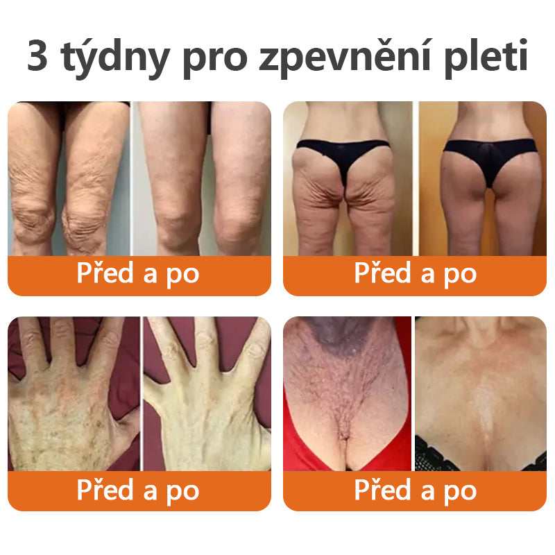Vyrobeno a odesláno z České republiky✨𝗧𝗟𝗢𝗣𝗔® AH-8 Zpevňující krém proti stárnutí (POSLEDNÍ DEN SLEVA 70%)