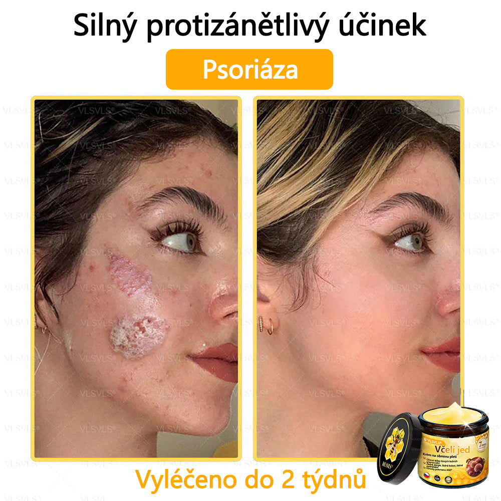 ✅VLSVLS™ Obnovující krém se včelím jedem🐝💥