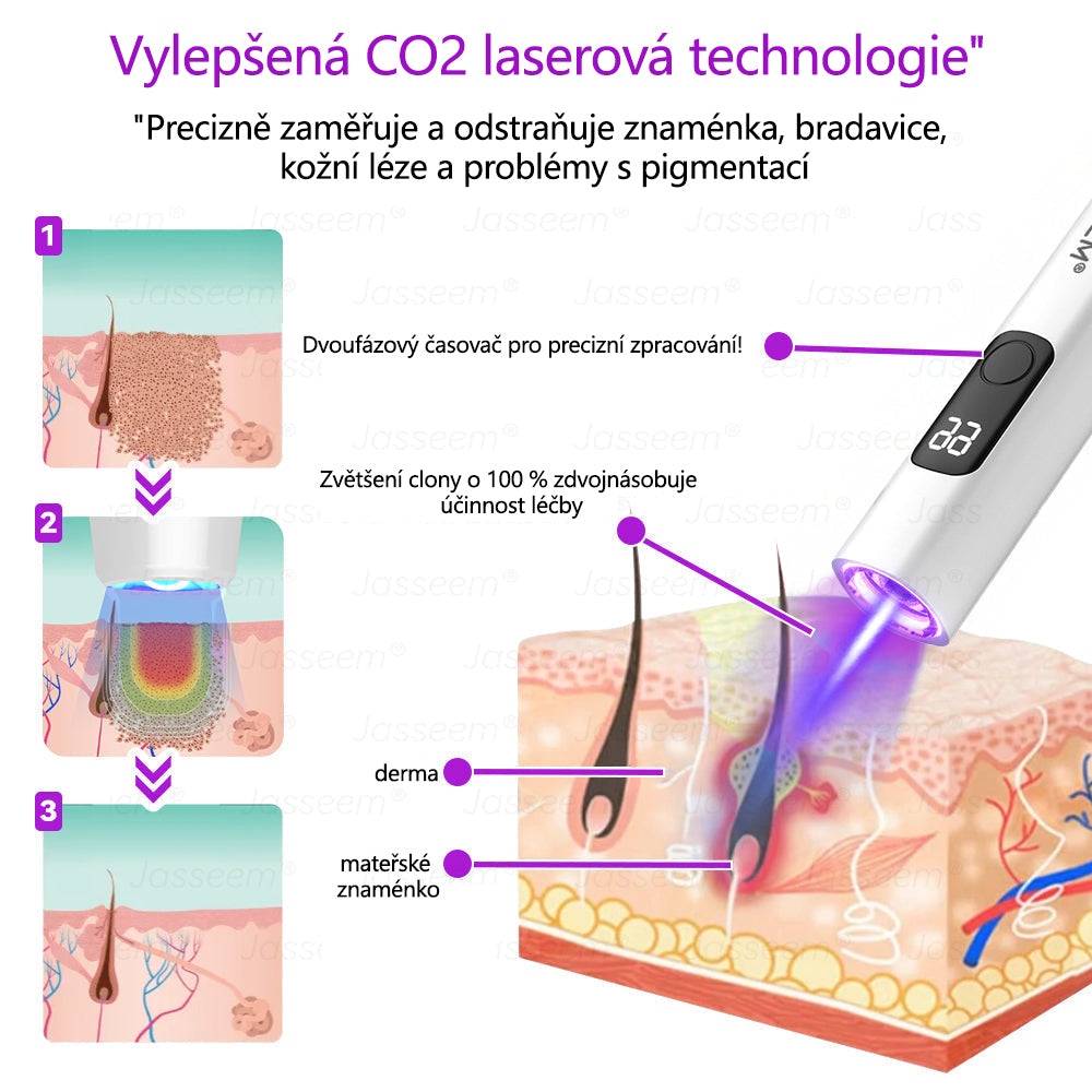 𝐉𝐚𝐬𝐬𝐞𝐞𝐦® Pokročilé neinvazivní pero s CO₂ laserem na opravu pokožky 💕 (šetrně odstraňuje bradavice, mateřská znaménka, stařecké skvrny a kožní značky - bez bolesti a rozruchu!)