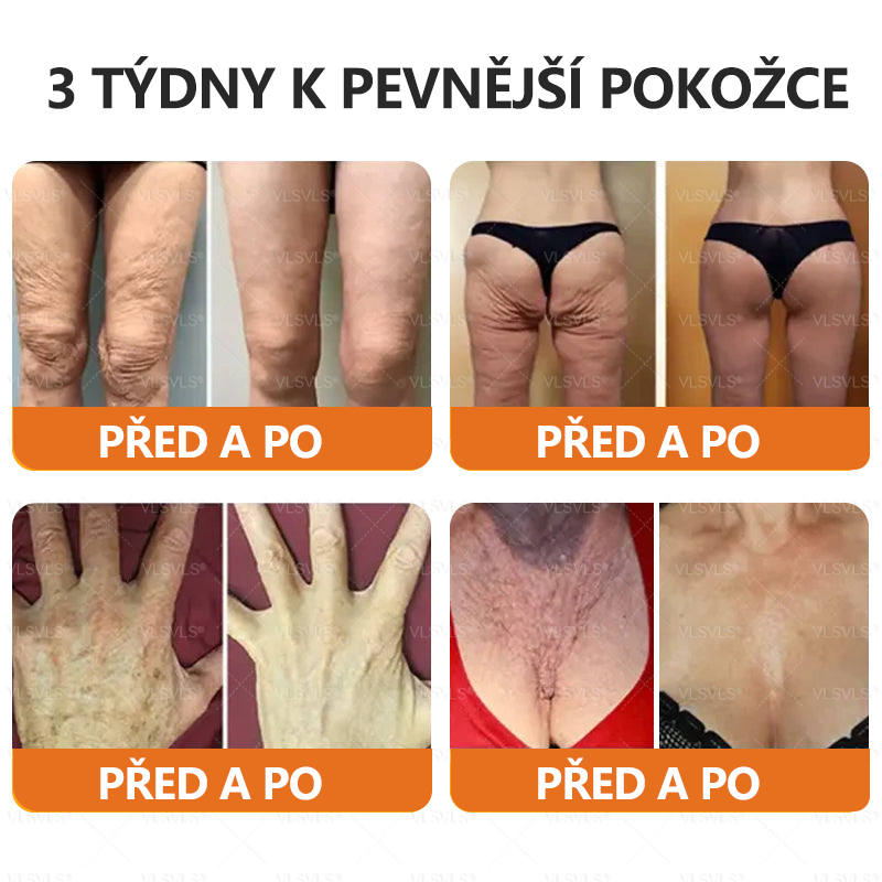 Vyrobeno a odesláno z České republiky ✨Foulme® Obnovující krém se včelím jedem ⏰ POSLEDNÍ DEN SLEVA 80%