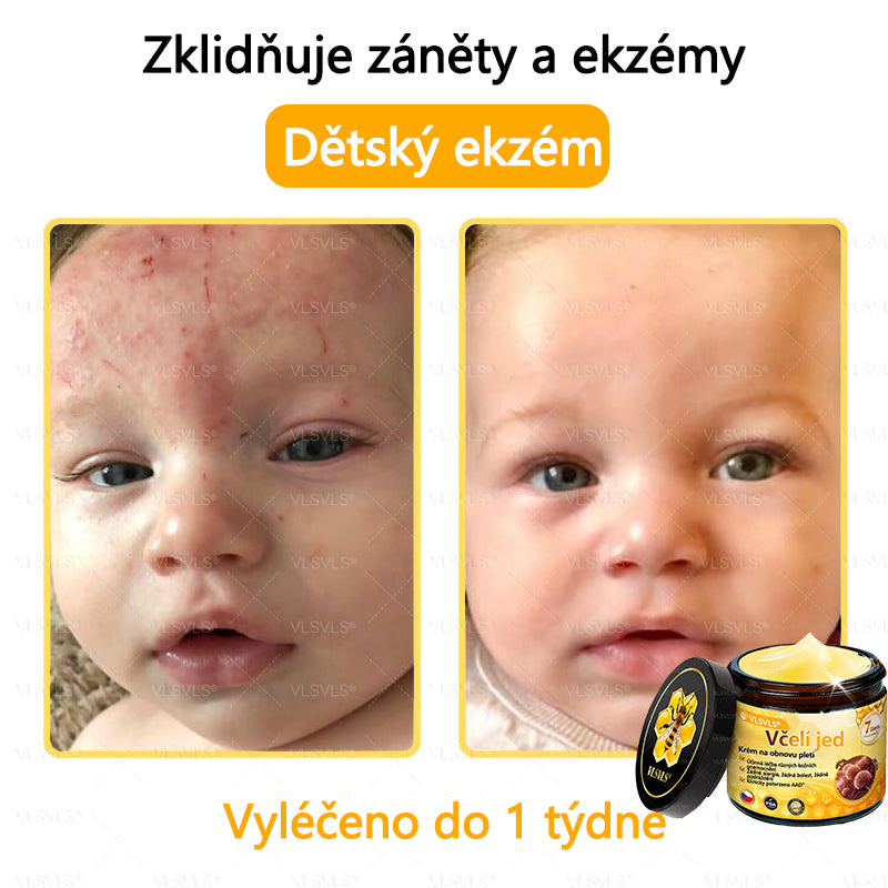 ✅VLSVLS™ Obnovující krém se včelím jedem🐝💥