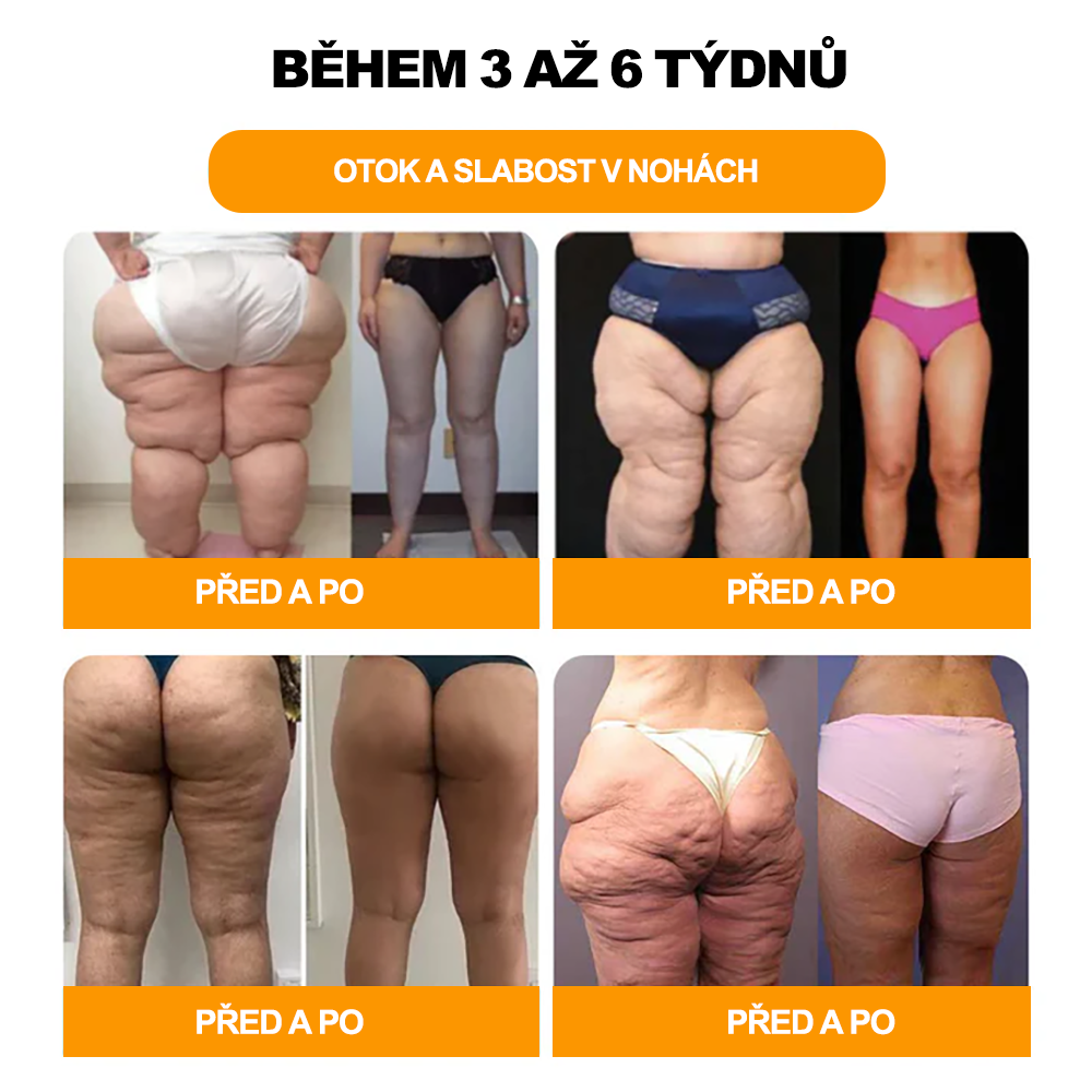 🔥💫 Poslední den na získání slevy 70 %: Aeehfeng® Včelí jed a 30 bylinek pro detoxikaci nohou a korálky pro tvarování těla - ✨Doporučeno Evropskou lymfatickou asociací (ELF) ✨🧀