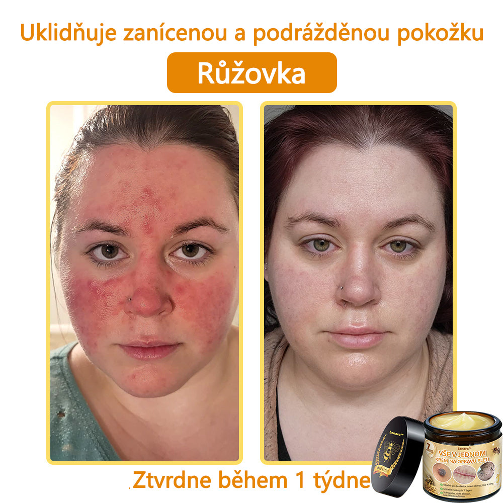 【Oficiální značkový obchod】🎇𝐋𝐞𝐧𝐚𝐫𝐨™ Včelí jed všestranný krém, schválený českými dermatology (👩 Doporučeno Českou společností pro kožní a pohlavní nemoci CGDV)💥
