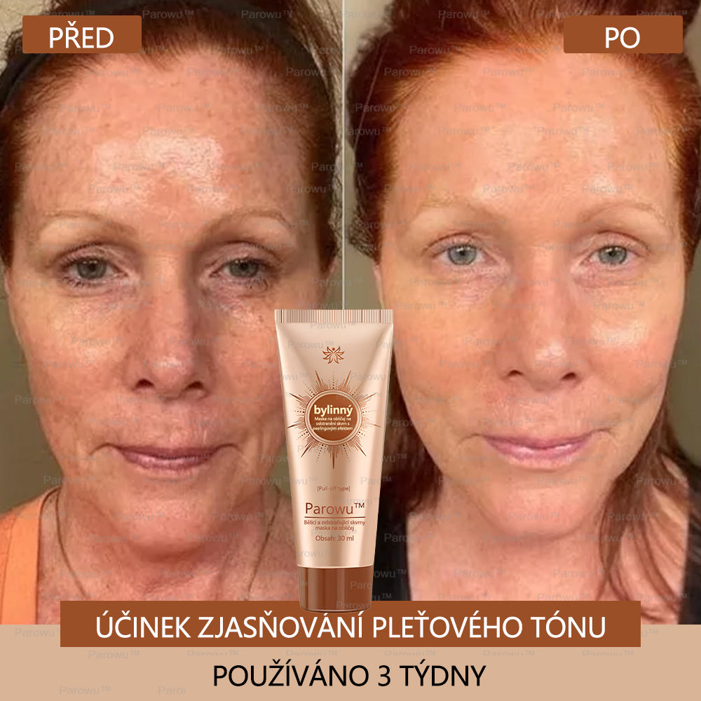 🧡Rowpin® bělící a skvrny odstraňující pleťová maska Vhodná na obličej i tělo - 👩⚕️ Přírodní složky trvale odstraňují stařecké skvrny, pihy, sluneční a jaterní skvrny.💥