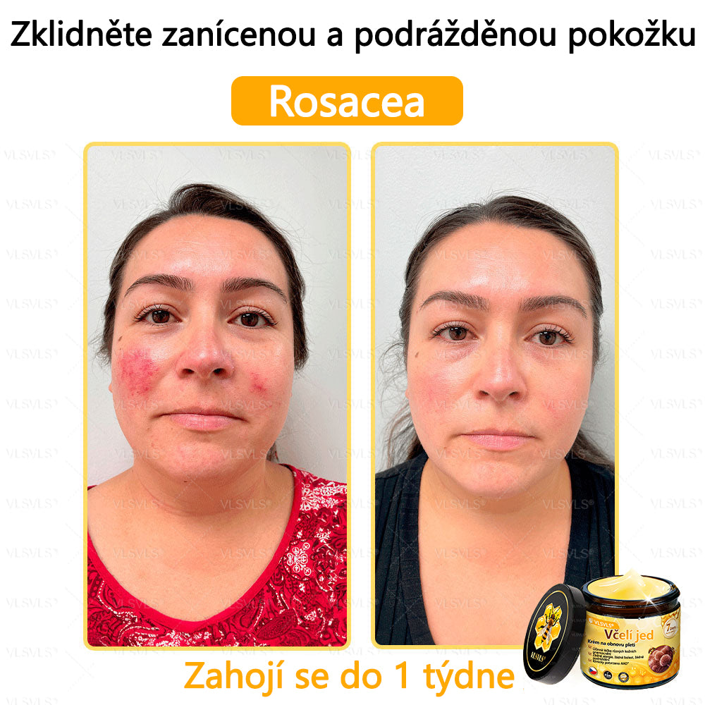 ✅VLSVLS™ Obnovující krém se včelím jedem🐝💥