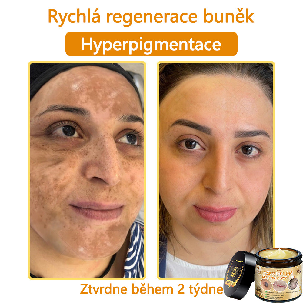 【Oficiální značkový obchod】🎇𝐋𝐞𝐧𝐚𝐫𝐨™ Včelí jed všestranný krém, schválený českými dermatology (👩 Doporučeno Českou společností pro kožní a pohlavní nemoci CGDV)💥