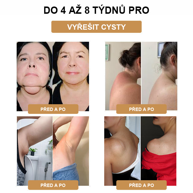 💃【🫧𝗗𝗼𝗯𝗶́𝗿𝗸𝗮🫧】2024 Nový ultrazvukový liposukční detoxikační náramek SlimPulse™(Doporučení lékaře👨⚕)