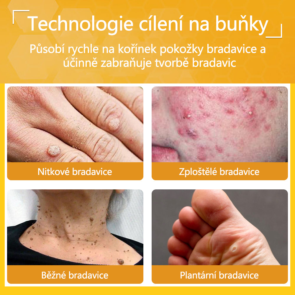 ✅flysmus® Silný krém se včelím jedem - Doporučeno dermatologickými odborníky. Účinný proti bradavicím, boulím, lézím, infekcím a jizvám.🐝
