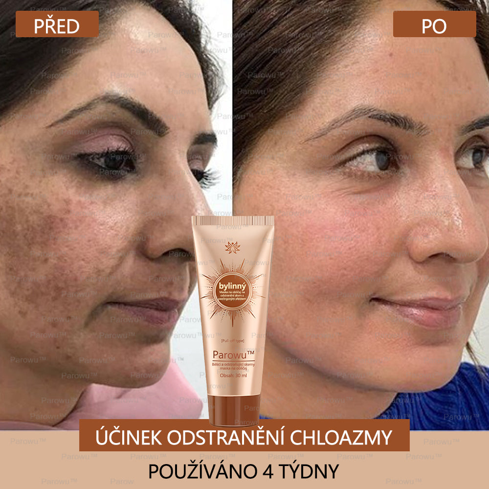 🧡Rowpin® bělící a skvrny odstraňující pleťová maska Vhodná na obličej i tělo - 👩⚕️ Přírodní složky trvale odstraňují stařecké skvrny, pihy, sluneční a jaterní skvrny.💥
