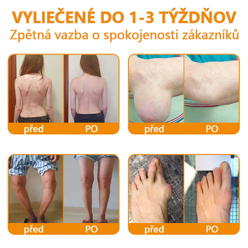 🔥💫Ourlyard™ Hořčíkový olej a včelí jed na hojení kloubů ve spreji👨⚕️Cure bolesti kloubů za pouhé 4 týdny, bez zpětného efektu🔥🔥