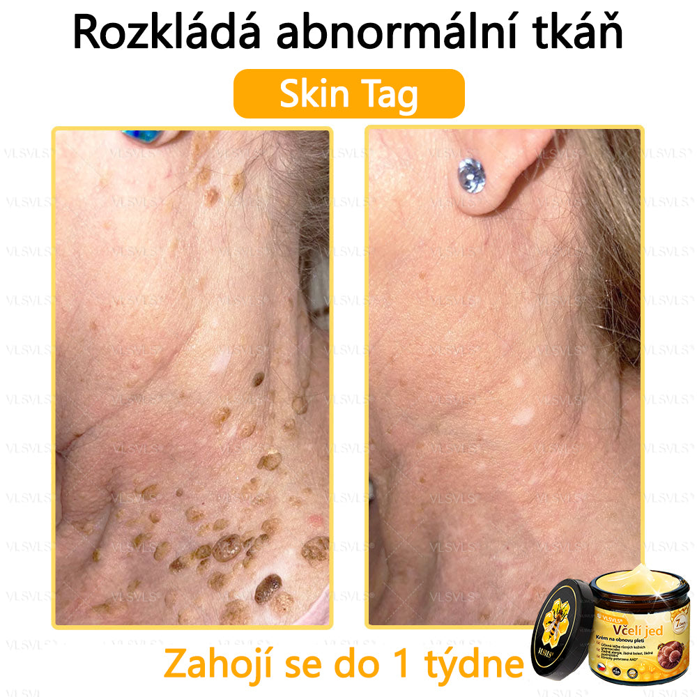 ✅VLSVLS™ Obnovující krém se včelím jedem🐝💥