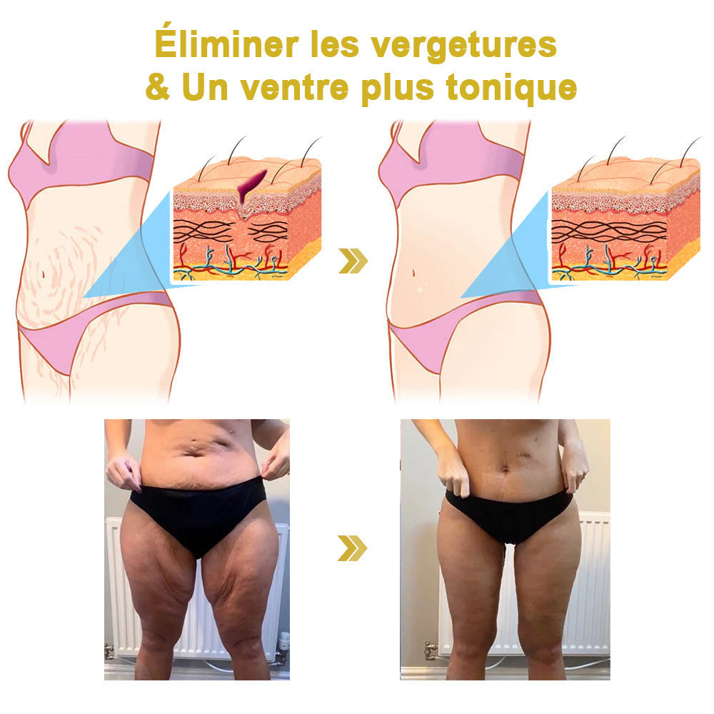 Moondar™ zpevňující krém🍑 : Obnovuje pružnost pokožky 🛍️ Sleva na poslední den: 25% sleva