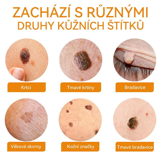 💥🔥𝐕o𝐬𝐨𝐱𝐚™ 𝐕č𝐞𝐥í𝐦 𝐉𝐞𝐝𝐞𝐦 𝐍𝐚 𝐎𝐝𝐬𝐭𝐫𝐚𝐧ě𝐧í 𝐁𝐫𝐚𝐝𝐚𝐯𝐢𝐜 𝐀 𝐙𝐧𝐚𝐦é𝐧𝐞𝐤 𝐊𝐫é𝐦🐝🐝(🔥𝐏𝐫𝐨𝐩𝐚𝐠𝐚č𝐧í 𝐚𝐤𝐜𝐞 𝐧𝐚 𝐩𝐨𝐬𝐥𝐞𝐝𝐧í 𝐝𝐞𝐧 𝟖𝟎% 𝐬𝐥𝐞𝐯𝐚)🔥💥✨