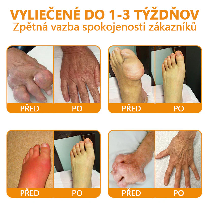 🔥💫Ourlyard™ Hořčíkový olej a včelí jed na hojení kloubů ve spreji👨⚕️Cure bolesti kloubů za pouhé 4 týdny, bez zpětného efektu🔥🔥