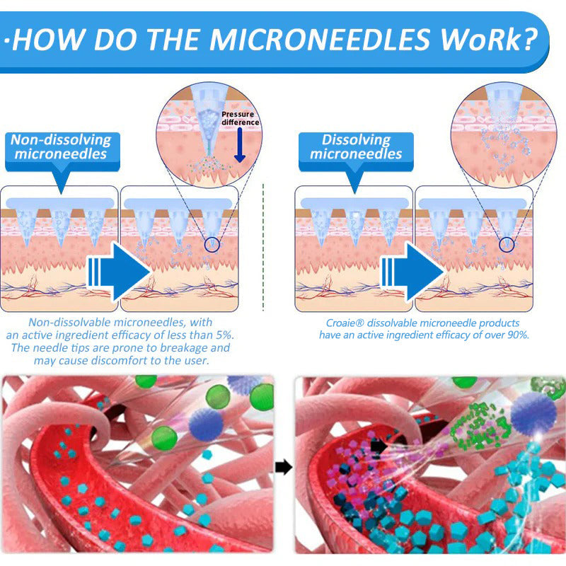 Croaie® Nano Microneedle Patch with SMGT-GLP-1 & Matrixyl 3000 – Slimming,👨⚕️👨⚕️ Skin Tightening, Blood Sugar Support, No Injection, 7-Day Result