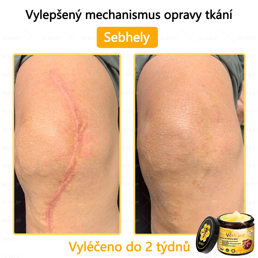 ✅VLSVLS™ Obnovující krém se včelím jedem🐝💥