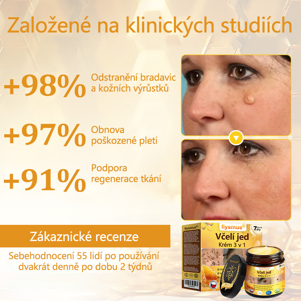 ✅flysmus® Silný krém se včelím jedem - Doporučeno dermatologickými odborníky. Účinný proti bradavicím, boulím, lézím, infekcím a jizvám.🐝