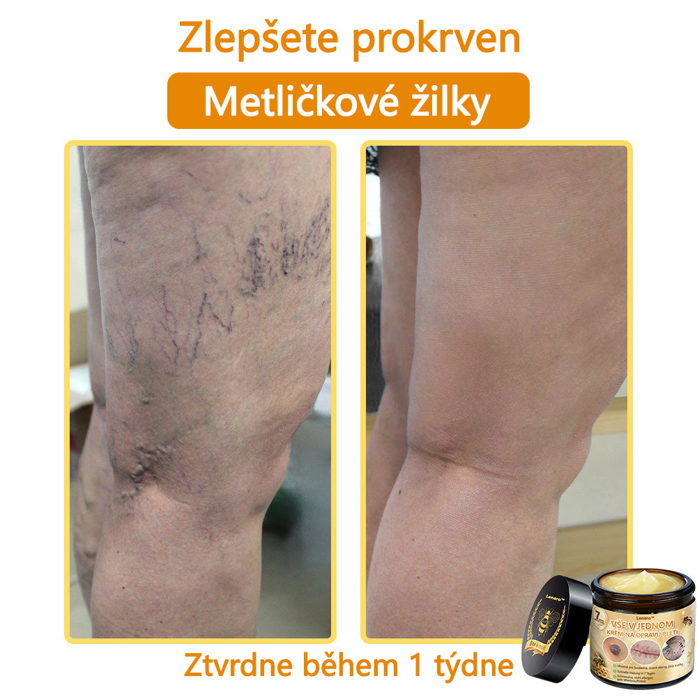 【Oficiální značkový obchod】🎇𝐋𝐞𝐧𝐚𝐫𝐨™ Včelí jed všestranný krém, schválený českými dermatology (👩 Doporučeno Českou společností pro kožní a pohlavní nemoci CGDV)💥