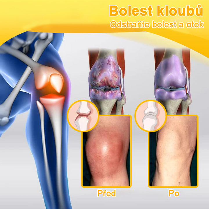 𝑭𝑨𝑻𝑶𝑵𝑮® Krém proti bolesti a hojení kostí ze včelího jedu (Výhradně pro seniory a na doporučení NVOC)🧨