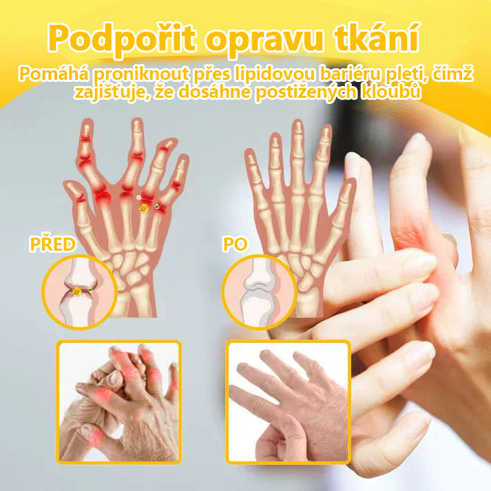 🔥💫Ourlyard™ Hořčíkový olej a včelí jed na hojení kloubů ve spreji👨⚕️Cure bolesti kloubů za pouhé 4 týdny, bez zpětného efektu🔥🔥