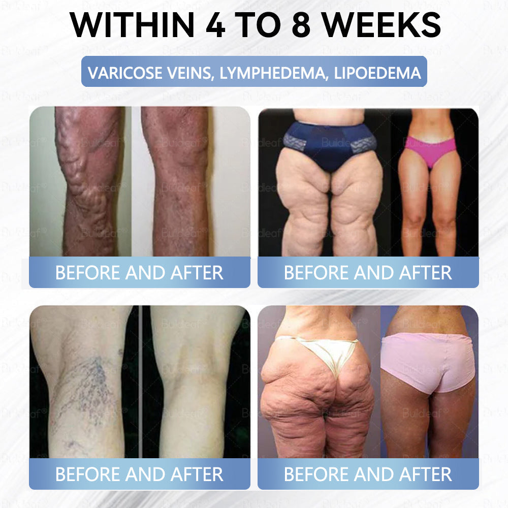 Croaie® Nano Microneedle Patch with SMGT-GLP-1 & Matrixyl 3000 – Slimming,👨⚕️👨⚕️ Skin Tightening, Blood Sugar Support, No Injection, 7-Day Result