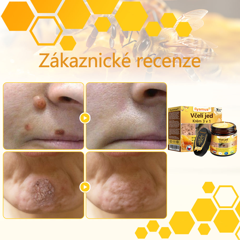 ✅flysmus® Silný krém se včelím jedem - Doporučeno dermatologickými odborníky. Účinný proti bradavicím, boulím, lézím, infekcím a jizvám.🐝
