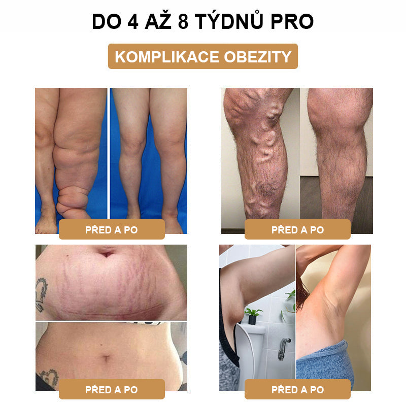 💃【🫧𝗗𝗼𝗯𝗶́𝗿𝗸𝗮🫧】2024 Nový ultrazvukový liposukční detoxikační náramek SlimPulse™(Doporučení lékaře👨⚕)