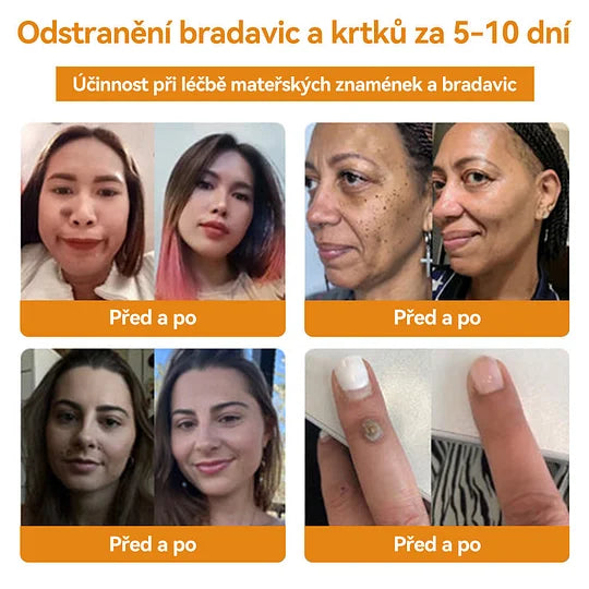 💥🔥𝐕o𝐬𝐨𝐱𝐚™ 𝐕č𝐞𝐥í𝐦 𝐉𝐞𝐝𝐞𝐦 𝐍𝐚 𝐎𝐝𝐬𝐭𝐫𝐚𝐧ě𝐧í 𝐁𝐫𝐚𝐝𝐚𝐯𝐢𝐜 𝐀 𝐙𝐧𝐚𝐦é𝐧𝐞𝐤 𝐊𝐫é𝐦🐝🐝(🔥𝐏𝐫𝐨𝐩𝐚𝐠𝐚č𝐧í 𝐚𝐤𝐜𝐞 𝐧𝐚 𝐩𝐨𝐬𝐥𝐞𝐝𝐧í 𝐝𝐞𝐧 𝟖𝟎% 𝐬𝐥𝐞𝐯𝐚)🔥💥✨