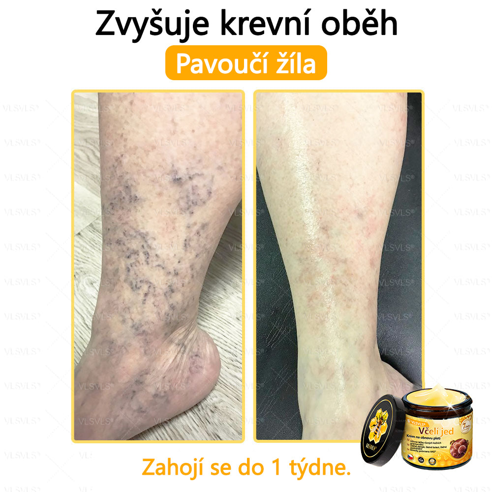 ✅VLSVLS™ Obnovující krém se včelím jedem🐝💥