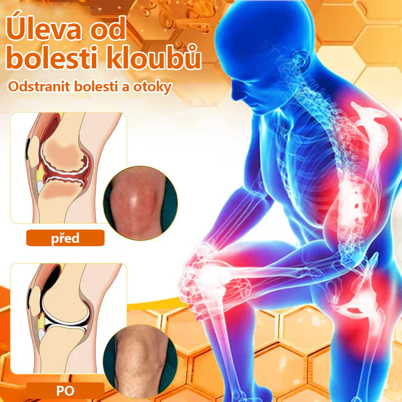 🔥💫Ourlyard™ Hořčíkový olej a včelí jed na hojení kloubů ve spreji👨⚕️Cure bolesti kloubů za pouhé 4 týdny, bez zpětného efektu🔥🔥